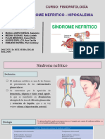 SINDROME NEFRITICO - HIPOKALEMIA Fisiopatología