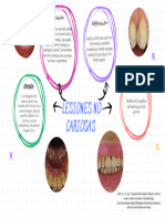 Lesiones No Cariosas