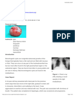 Bronchogenic Cyst