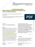 PT-BR (2018) Dandy-Walker Malformation-Like Condition Revealed by Refractory Schizophrenia A Case Report and Literature Review - Ilo.pt