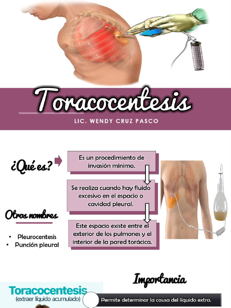 Sem 14 Toraconcentesis Paracentesis | PDF | Enfermedades y trastornos ...