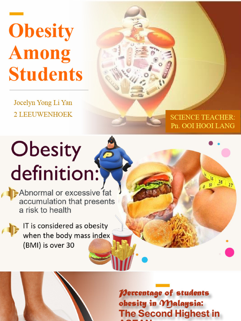 OBESITY-SN PPD | PDF | Obesity | Foods