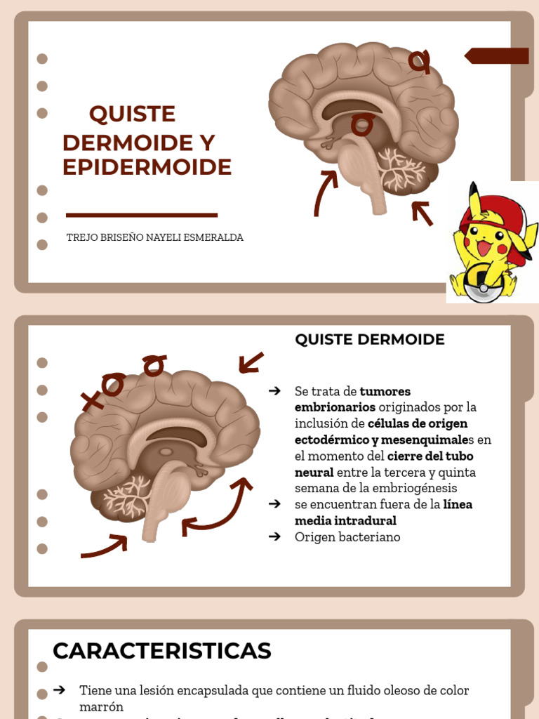 Quiste Dermoide y Epidermoide PDF Epidermis Meningitis