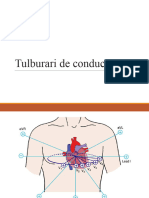 Tulburari de Conducere