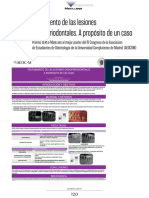 Tratamiento de Las Lesiones Endoperiodontales. A Propósito de Un Caso