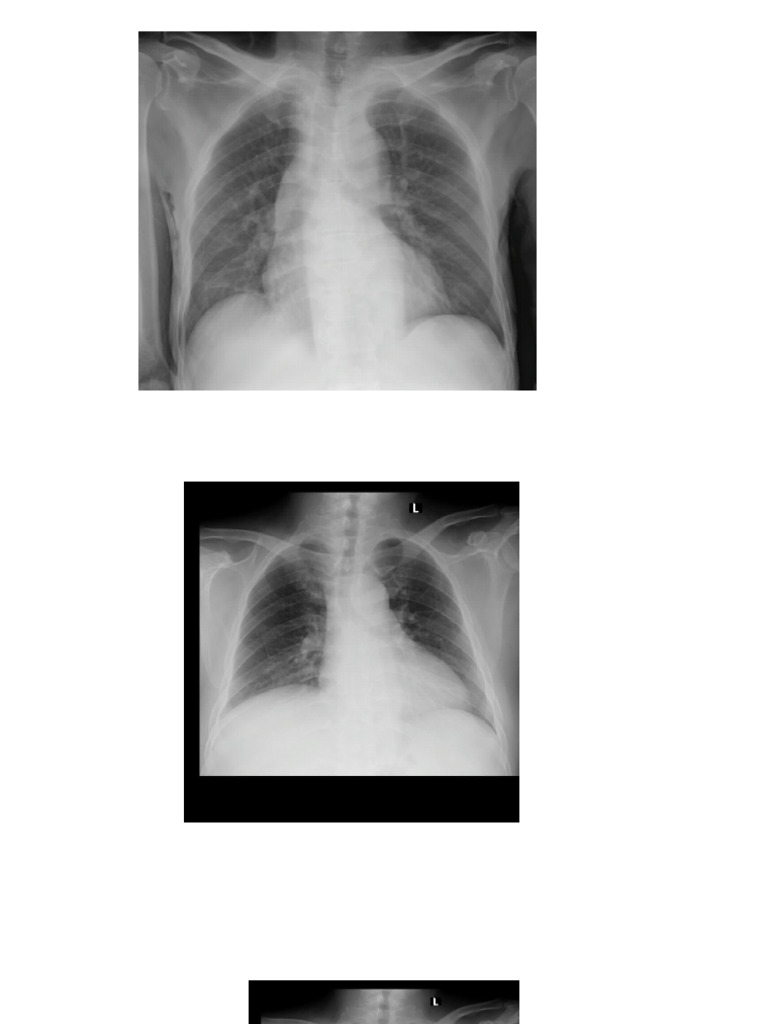 Rontgen Thorax Belajar Interpretasi | PDF