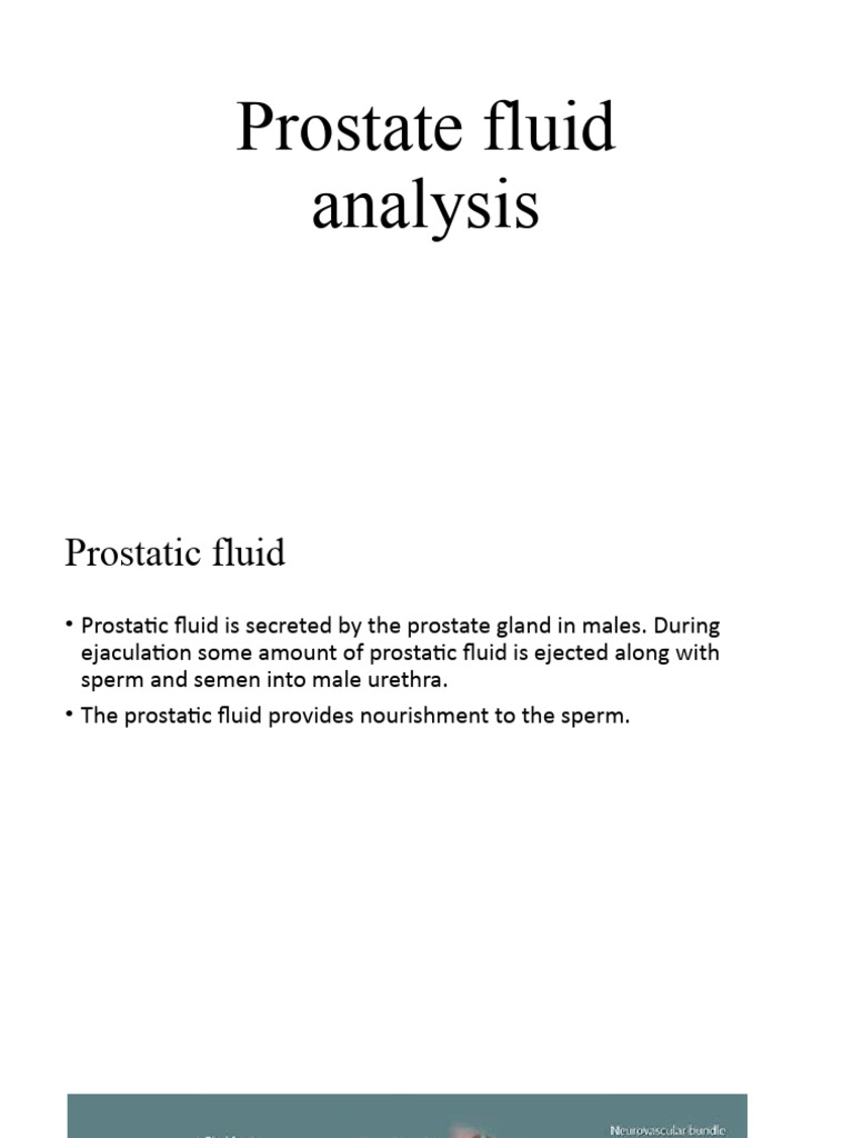 Increasing Prostate Fluid Production – NECJN