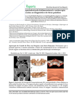 Tomografia Computadorizada Tridimensional e Endoscopia Virtual Aplicadas Ao Diagnostico de Torus Palatino1