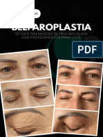 Blefaroplastia