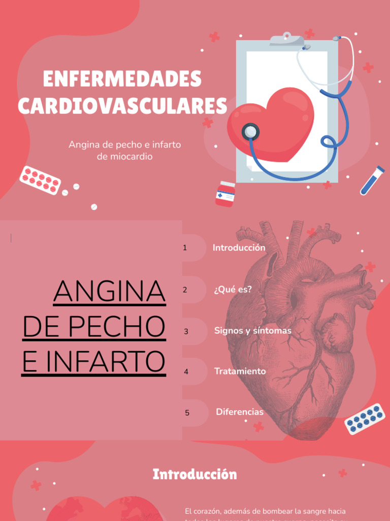 Causas y síntomas de cardiopatía isquémica | PDF | Infarto de miocardio ...