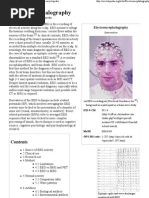 Download Electroencephalography - Wikipedia The Free Encyclopedia by Naren Elangovan SN71650364 doc pdf