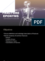 Fracture Eponyms