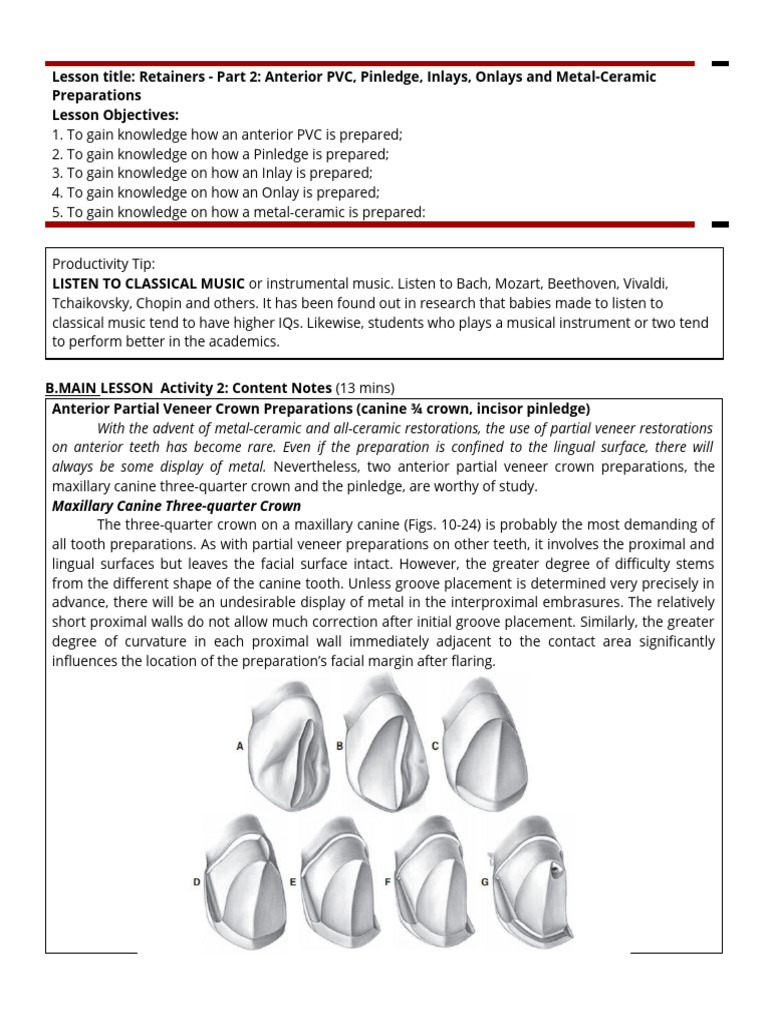 FPD lec.SAS.12 Anterior PVC Pinledge Inlays Onlays PFM PDF Human