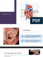 Infective Endocarditis Final