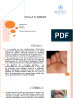 GUÌA 7, Verruga Plantar, Unidad II, Podologìa II (D-V-SP)