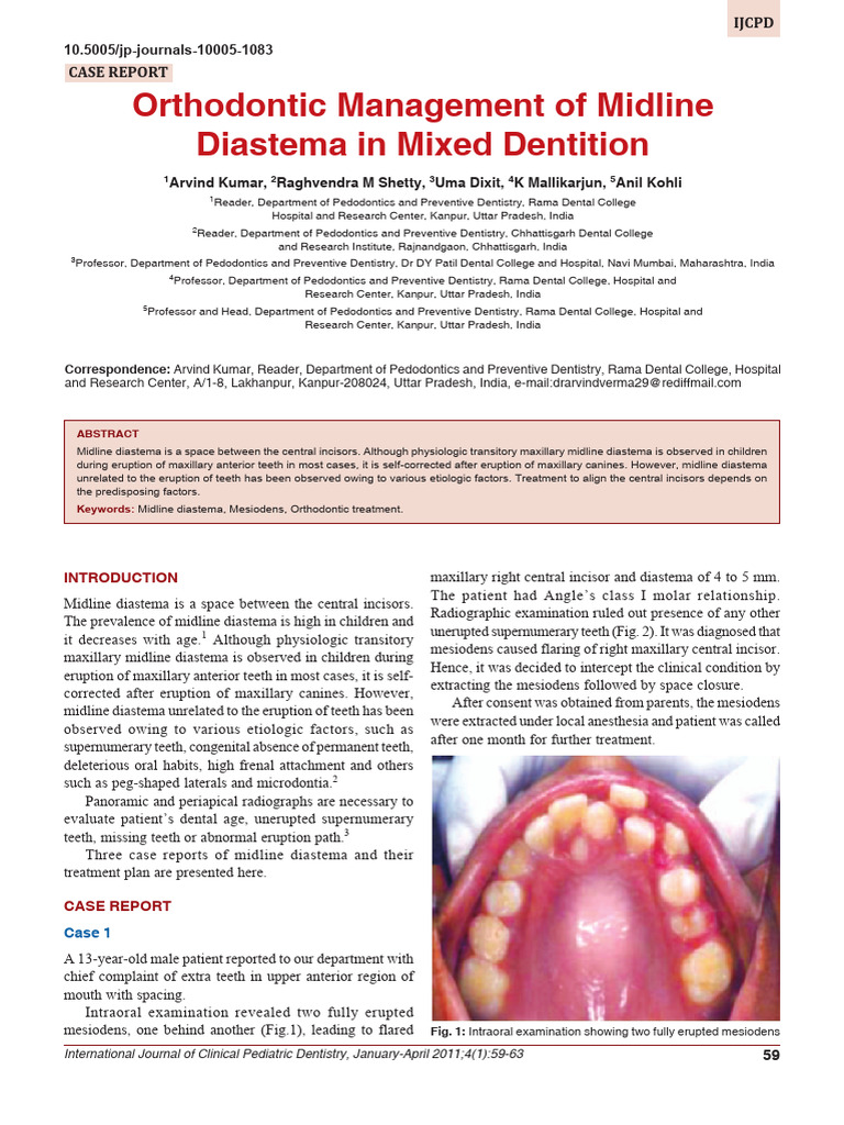 Orthodontic Management of Midline Diastema in Mixe | PDF | Wellness ...