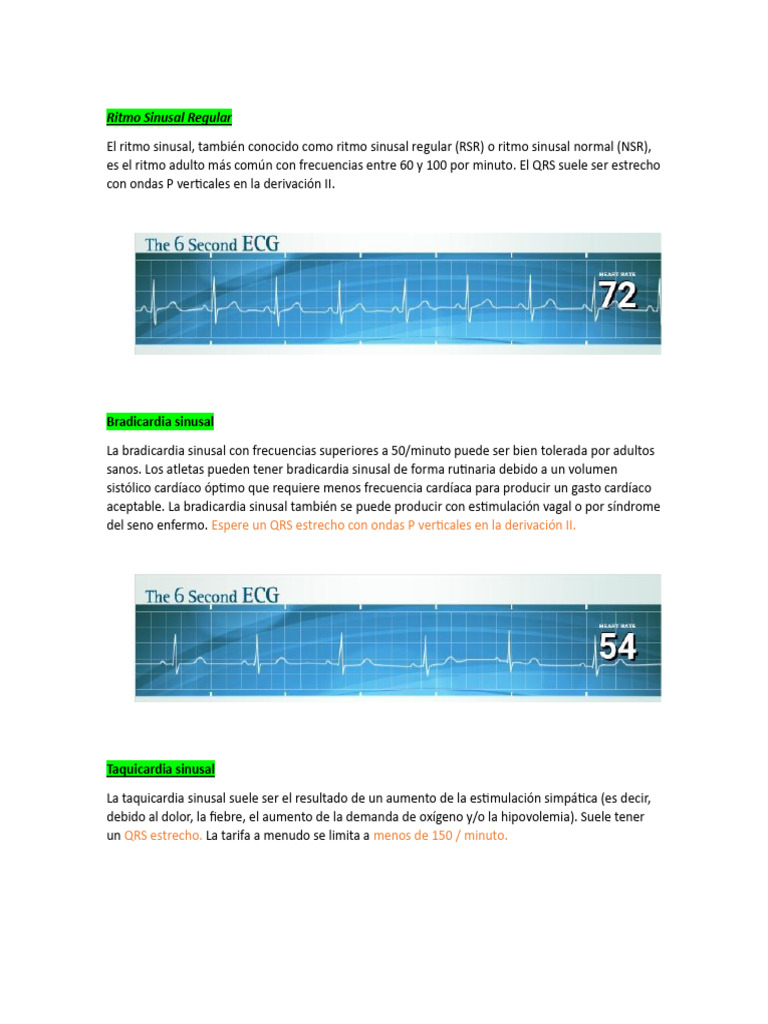 Ritmo Sinusal Regular y Variantes | PDF | Electrocardiografia | Corazón