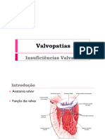 Valvopatias: Insuficiências Valvares