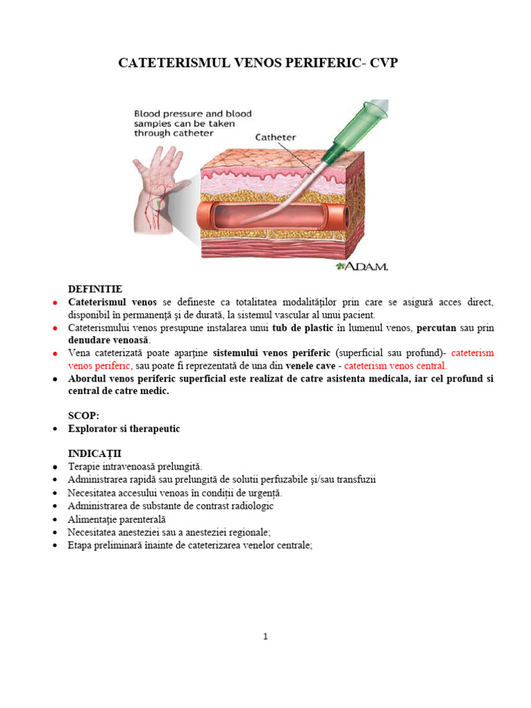 Montare Branula | PDF