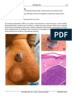 Carcinoma Basocelular