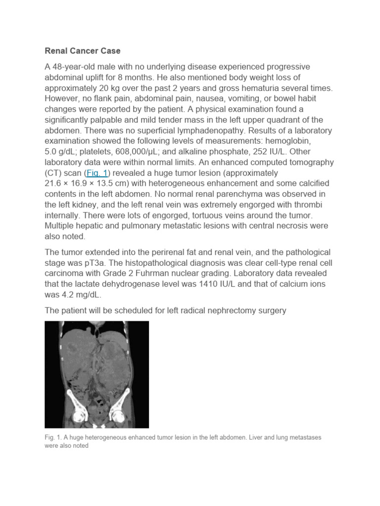 Renal Cancer Case-2 | PDF | Kidney | Ct Scan