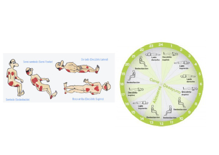 Reloj Cambio Postural | PDF