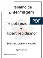 Hipotiroidismo