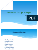 Diseases of The Lips & Tongue