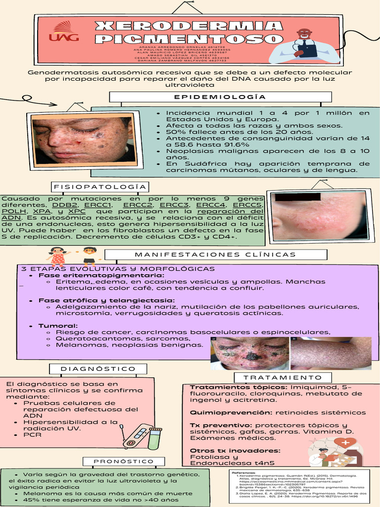 Xeroderma Pigmentoso: Diagnóstico y Tratamiento | PDF | Cáncer | Melanoma