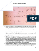 Caso 9 Ecg