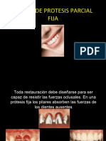 Diseodeprotesisparcialfija 100505142359 Phpapp01