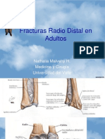 Fracturas Radio Distal