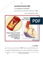 Myocardial Infraction