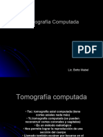 Tomografía Computada