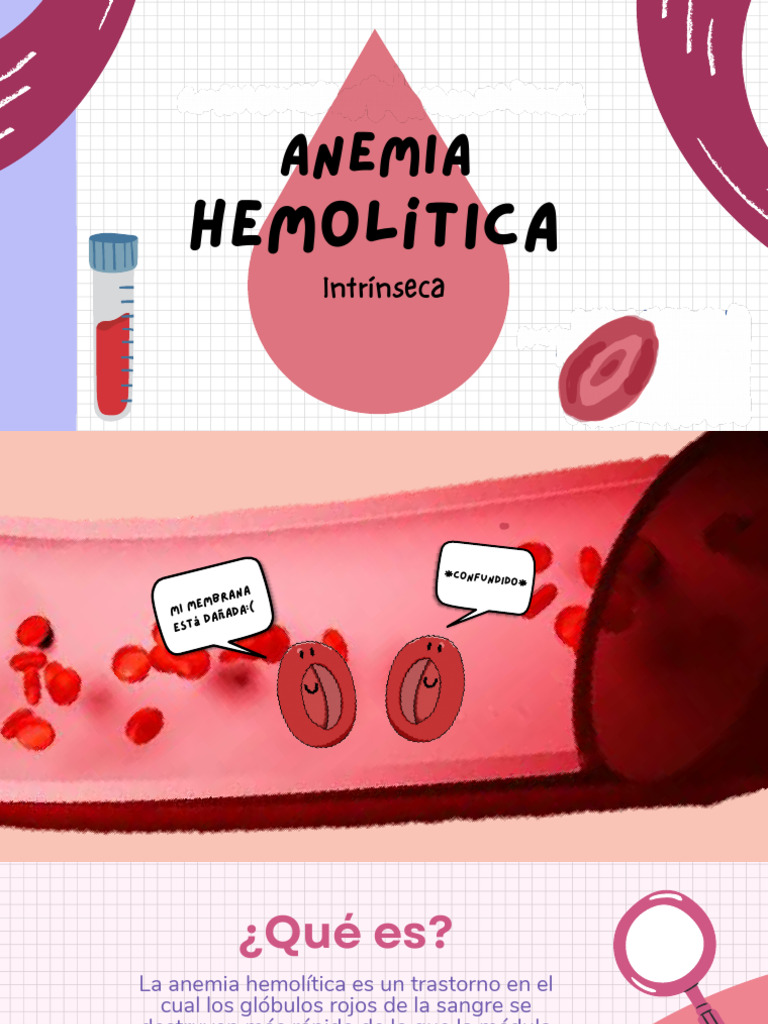 Anemia Hemolítica: Tipos y Síntomas | PDF | Glóbulo rojo | Anemia