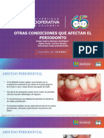 Trauma Oclusal