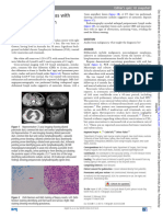 Head of Pancreas Mass With Biliary Obstruction: An Unusual Cause