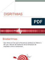 Disritmias