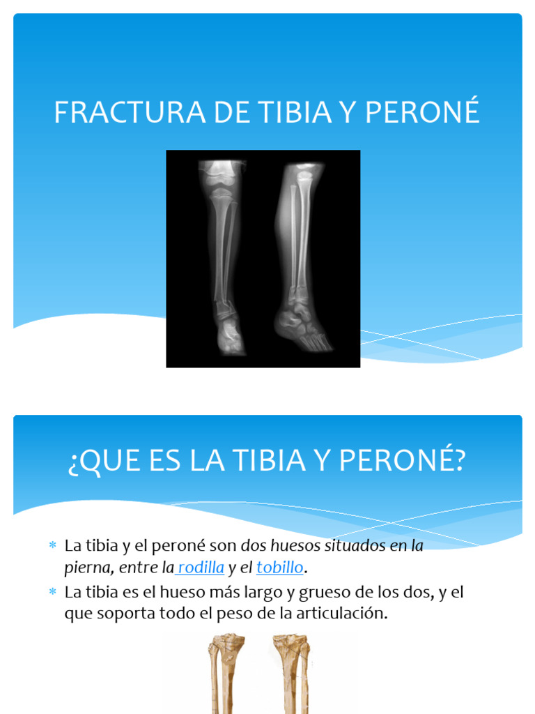 Tibia Peroné | PDF | Rodilla | Hueso