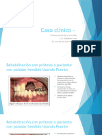 Caso Clinico Prótesis Parcial Fija y Removible