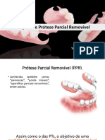 Noções de Prótese Removível