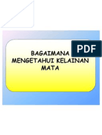 Program Indera Mata Di Puskesmas