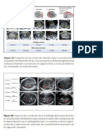 Neurosonografía