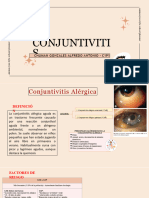 Conjuntivitis Alergica.