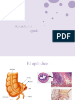 Apendicitis