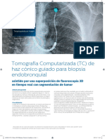 Philips Biopsy Pinehurst Casestudy HR Es