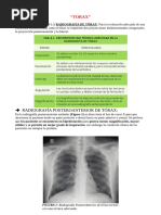 Diferencias entre Rx de Tórax AP y PA | PDF | Tórax (anatomía humana ...