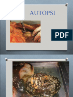 AUTOPSI