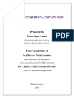 Biomechanics of Post Core System