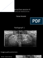 Interactive Session 4 Multilocular Radiolucencies